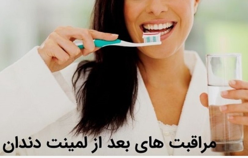 برای حفظ و نگهداری لمینت دندان، رعایت نکات زیر بسیار مهم است: