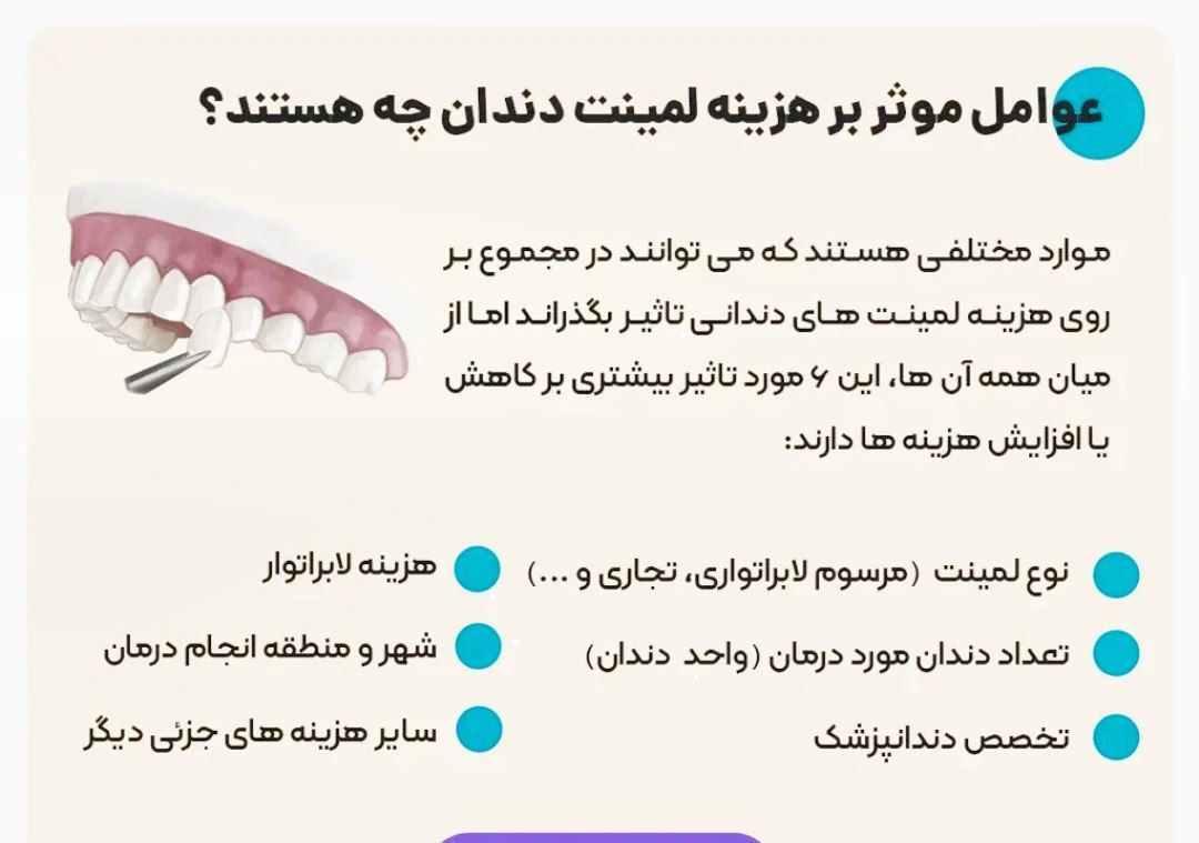 قیمت لمینت دندان بر چه اساس و مصوبه ای است؟