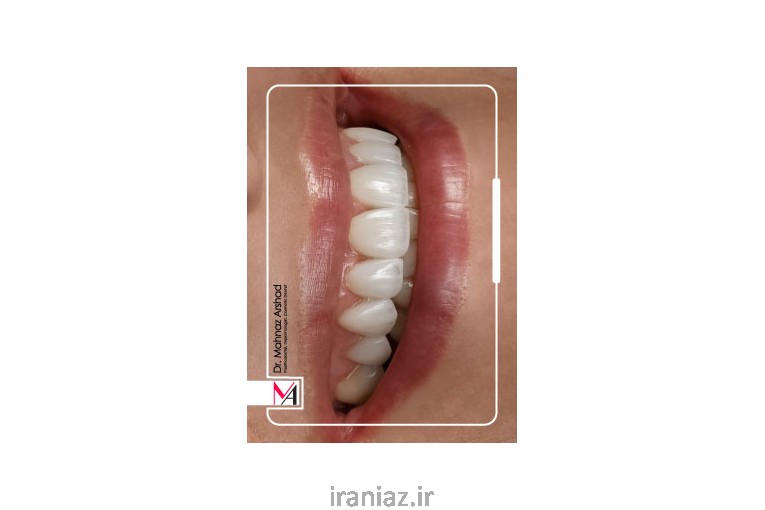 زیبایی لبخندت می‌تونه زندگیتو عوض کنه