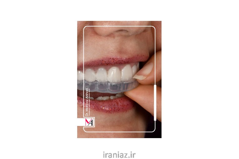 زیبایی لبخندت می‌تونه زندگیتو عوض کنه