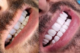 دندانپزشکی شرق