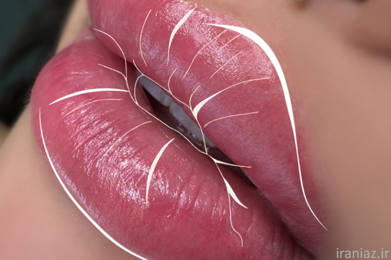 اجرای شیدینگ لب توسط الهام عابدینی