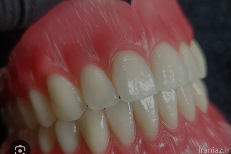 دندان مصنوعی به قیمت. پارسال