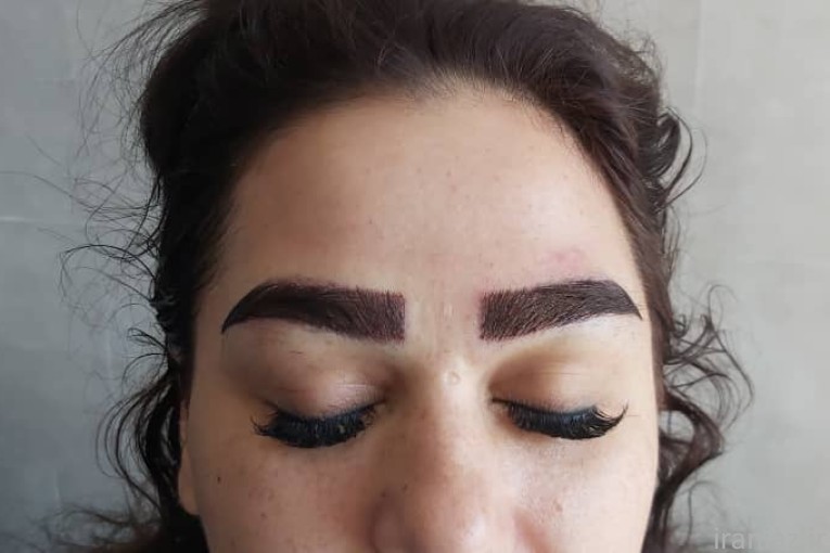 کاشت ابرو در شهریار