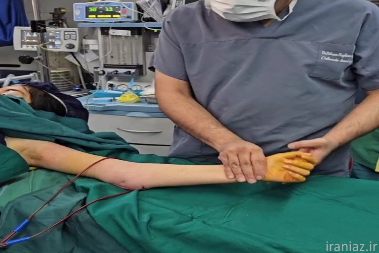 آرتروسکوپی شانه 