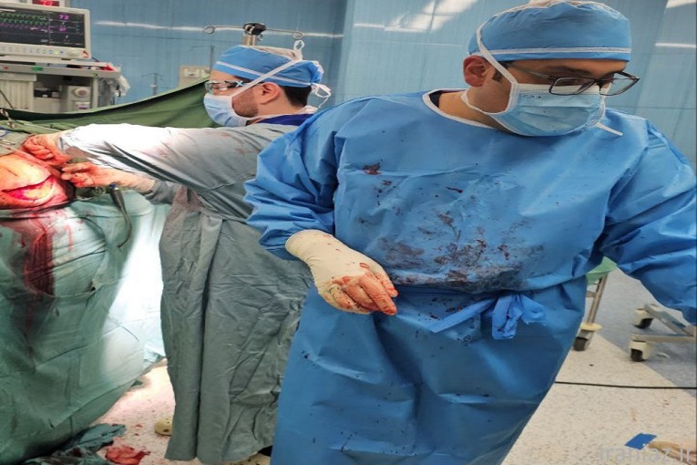 آرتروسکوپی شانه 