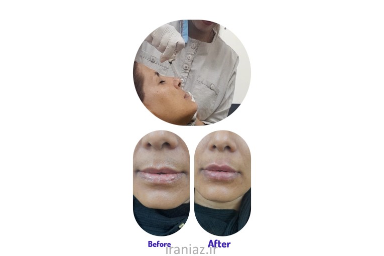 پوست مو و زیبایی