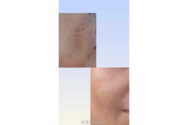 پوست مو و زیبایی