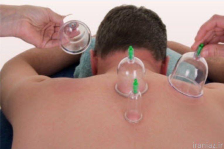 دانلود پاورپوینت حجامت و فواید آن