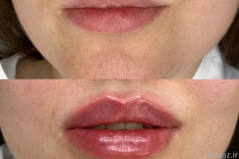 کلنیک لیزر و زیبایی تهرانپارس