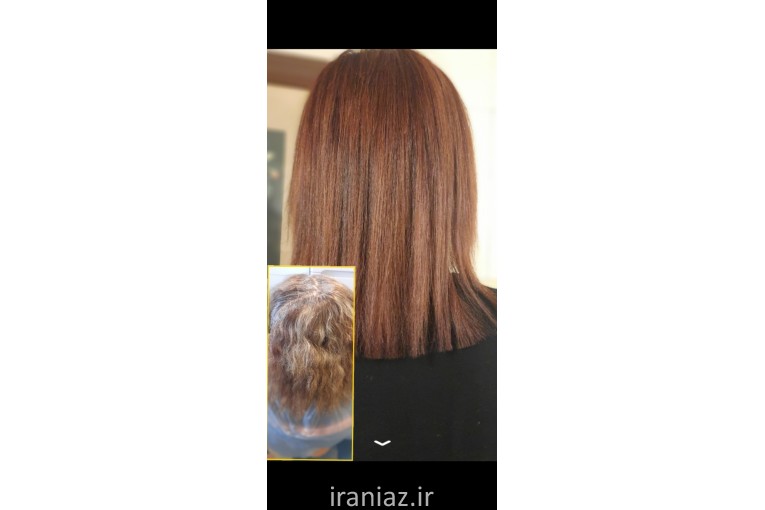 خدمات احیا و زیبایی مو