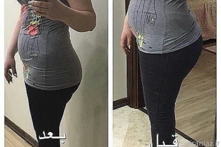 لاغری اصولی