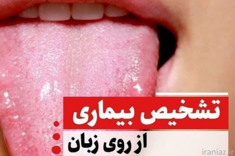 سلامتی درمان کبد چرب، دیابت 