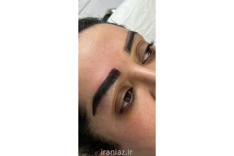 کاشت ابرو و مو