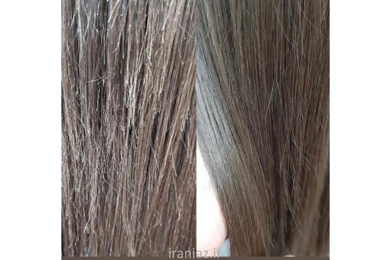 تخفیف ویژه کوتاهی تخصصی ژورنالی