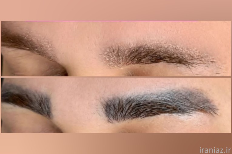 مدل ریمو ابرو 