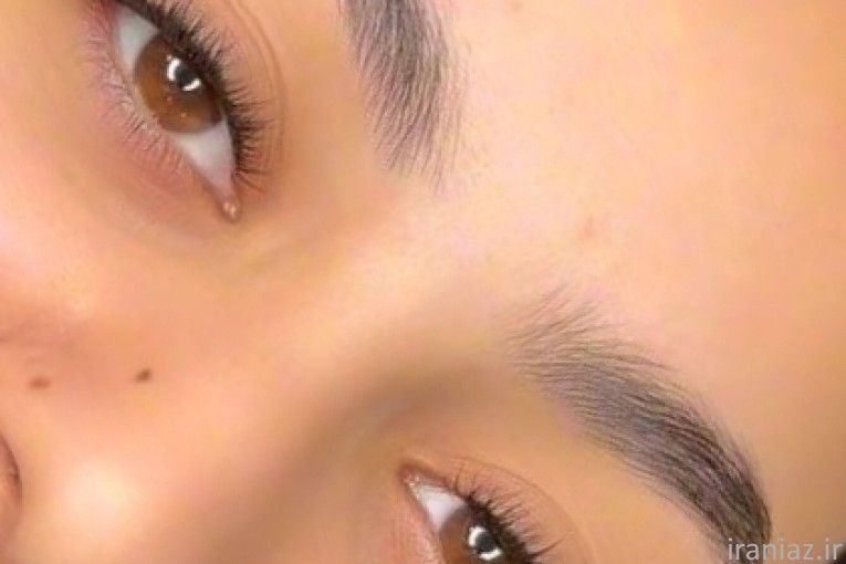 مدل رایگان کاشت مژه