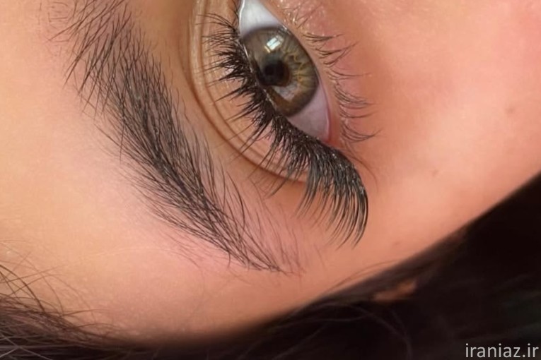 مدل رایگان کاشت مژه