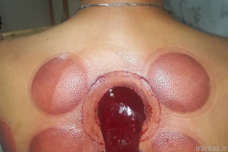 کلینیک طب سنتی ابن سینا