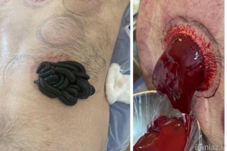 کلینیک طب سنتی ابن سینا