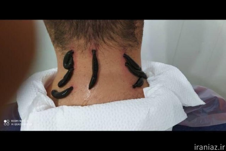 کلینیک طب سنتی ابن سینا