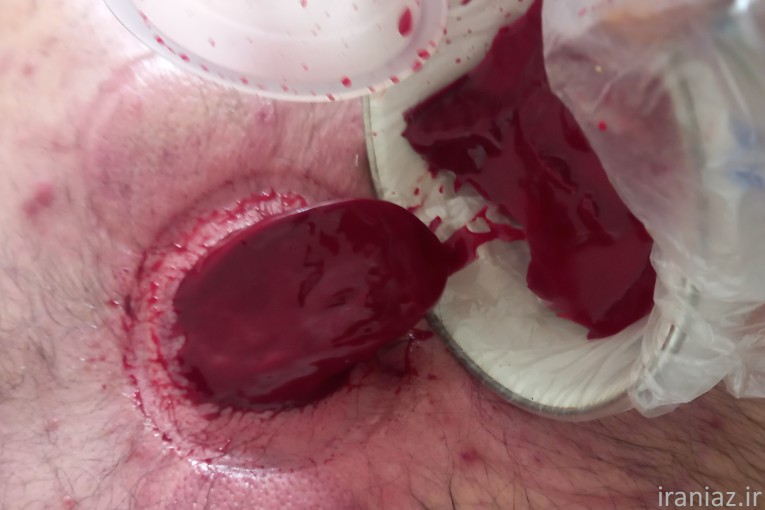 کلینیک طب سنتی ابن سینا