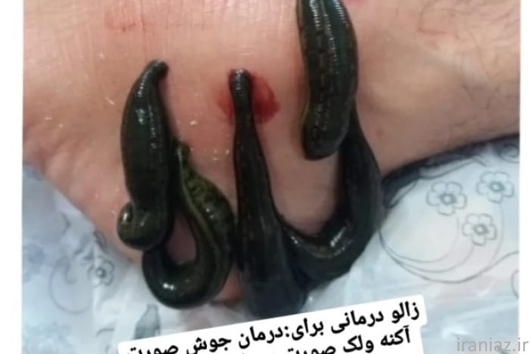 کلینیک طب سنتی ابن سینا