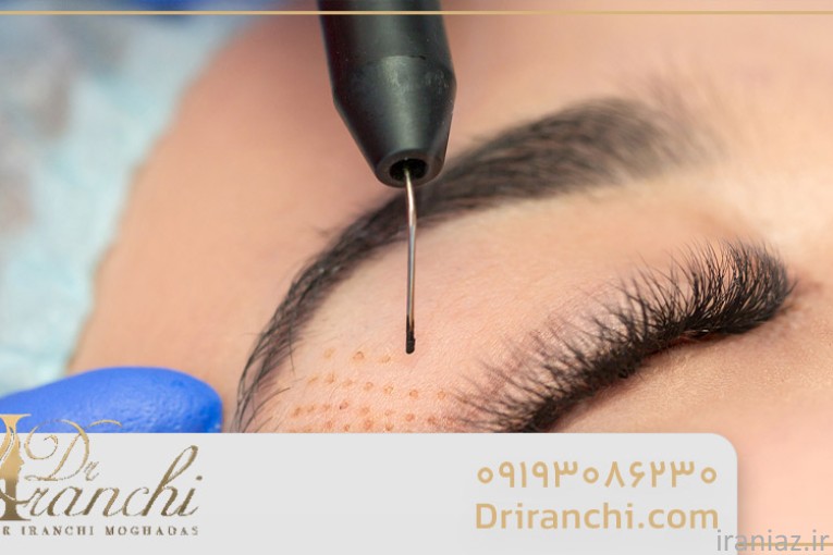 زیبایی بدون جراحی با دکتر ایرانچی