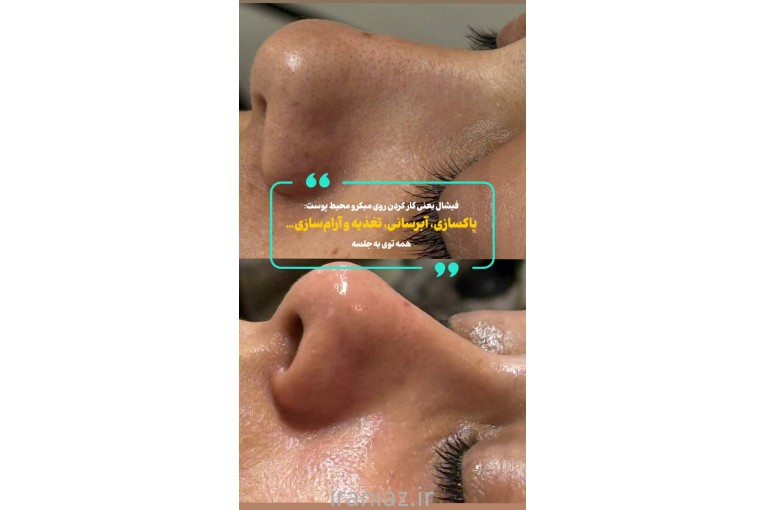 سالن زیبایی بانوان گیس ارا