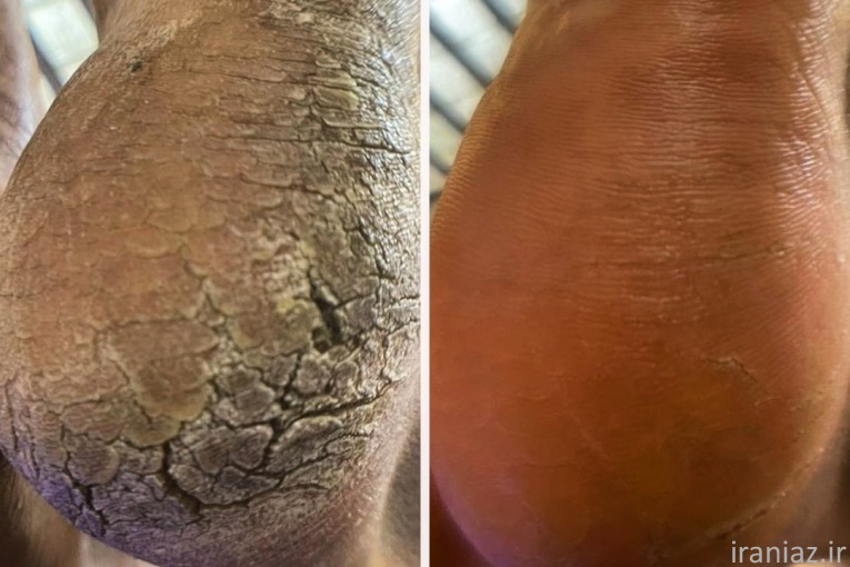 پدیکور تخصصی آقایان تهران