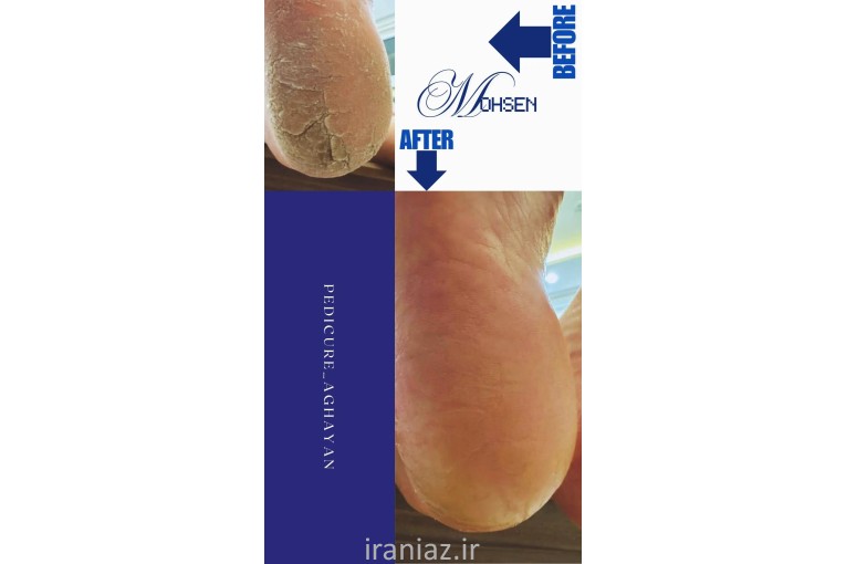 پدیکور تخصصی آقایان تهران