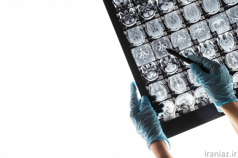 فتوگرافی و چاپ کلیشه و سی دی رادیولوژی