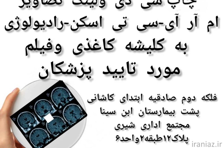 فتوگرافی و چاپ کلیشه و سی دی رادیولوژی