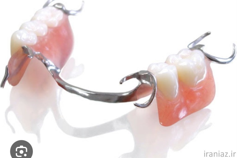 ساخت دندان مصنوعی
