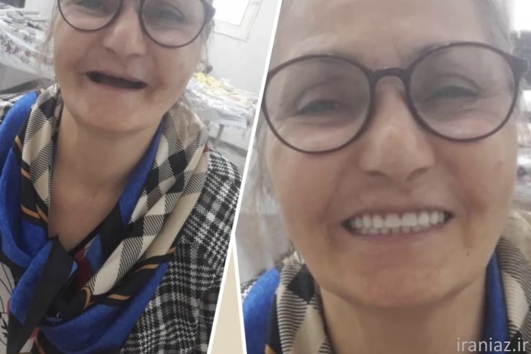 ساخت دندان مصنوعی