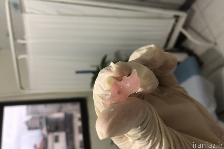 ساخت دندان مصنوعی
