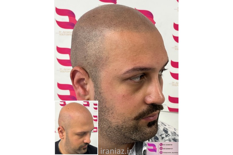 کلینیک زیبایی پوست و مو دکتر ایرملو