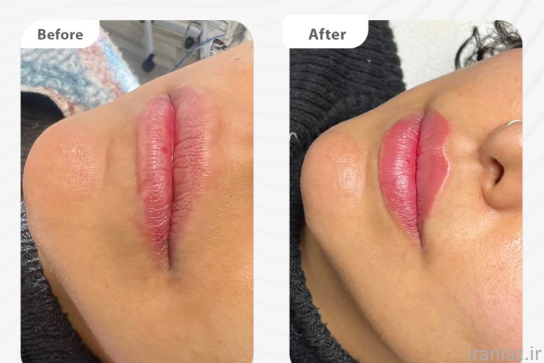 کلینیک زیبایی پوست و مو دکتر ایرملو