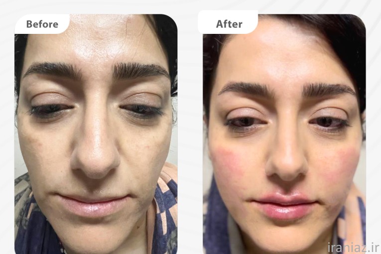 کلینیک زیبایی پوست و مو دکتر ایرملو