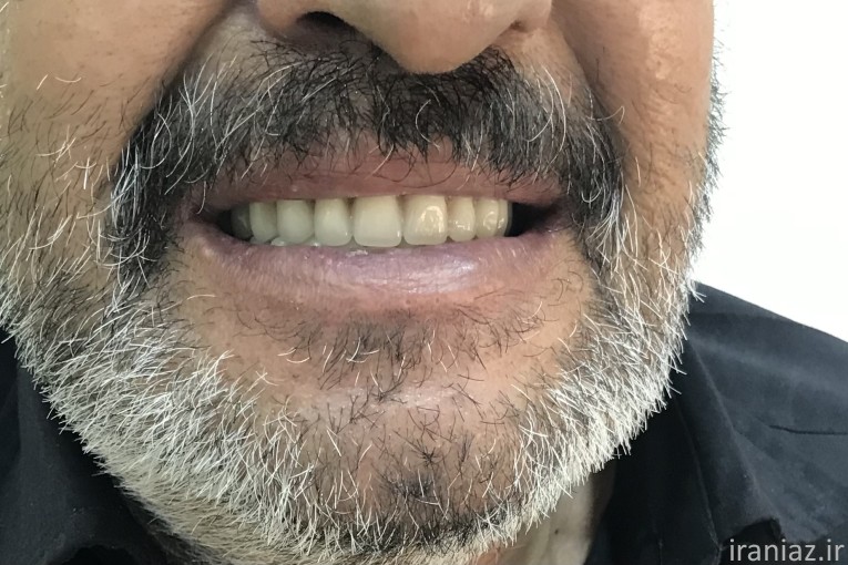 لابراتوار دندانسازی 