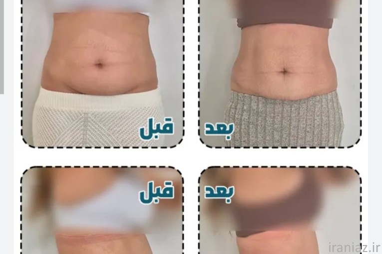لاغری و تناسب اندام