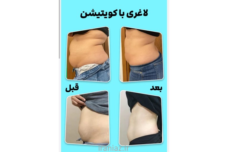 لاغری و تناسب اندام