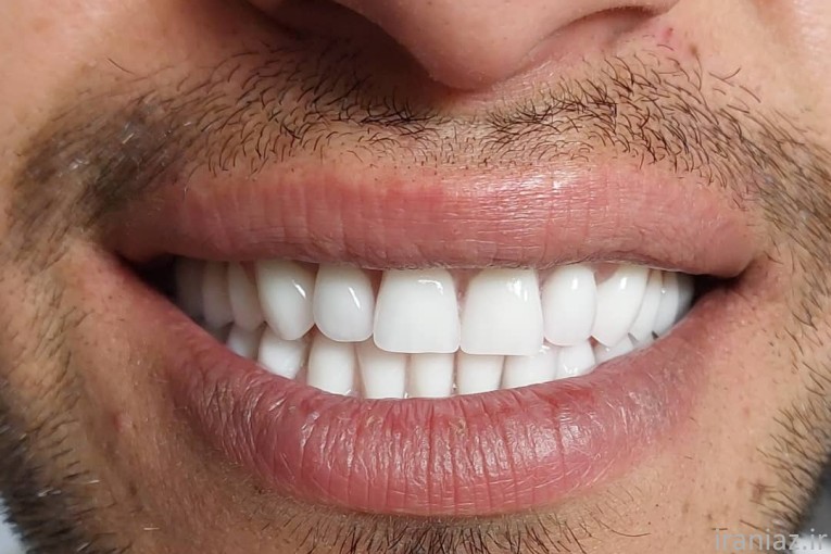 دندانسازی دکتر عارفخانی 