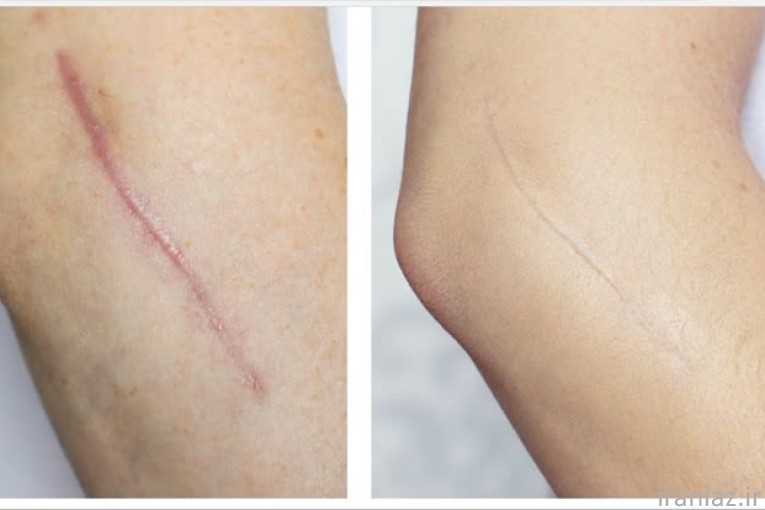 آموزش کاموفلاژ