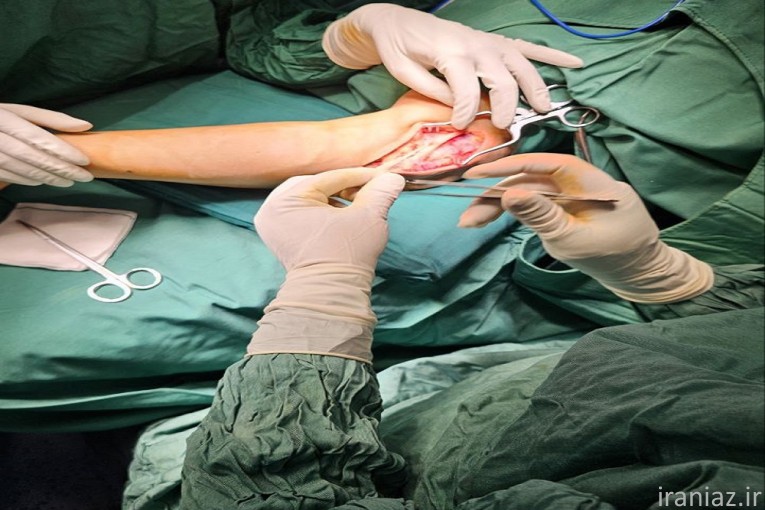 آسیب شبکه بازویی