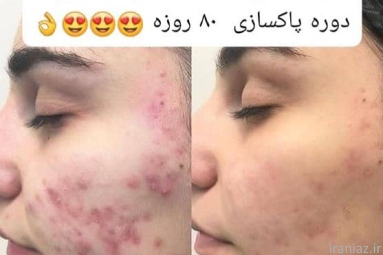 مشاوره  طب سنتی    