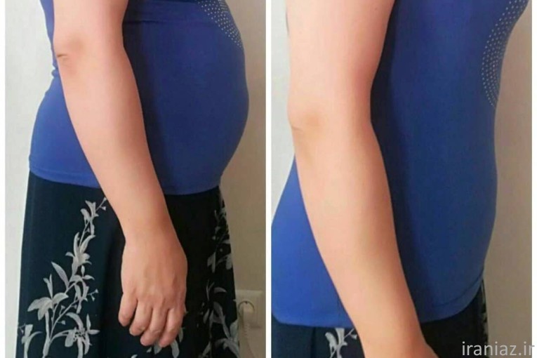 مشاوره  طب سنتی    