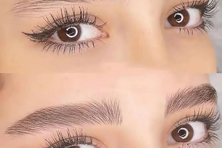 میکروبلیدینگ ابرو