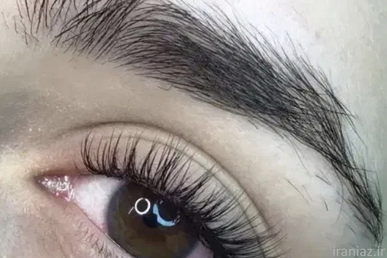 احیای مو،لیفت ابرو،کاشت مژه