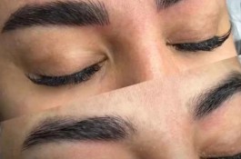  میکروپیگمنتیشن(مریم حمزه ای)